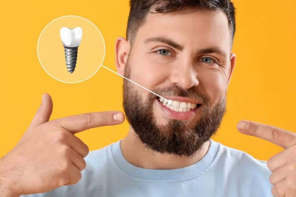 Dental Implant San Jose