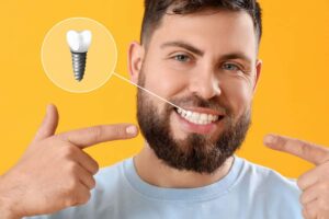 Dental Implant San Jose