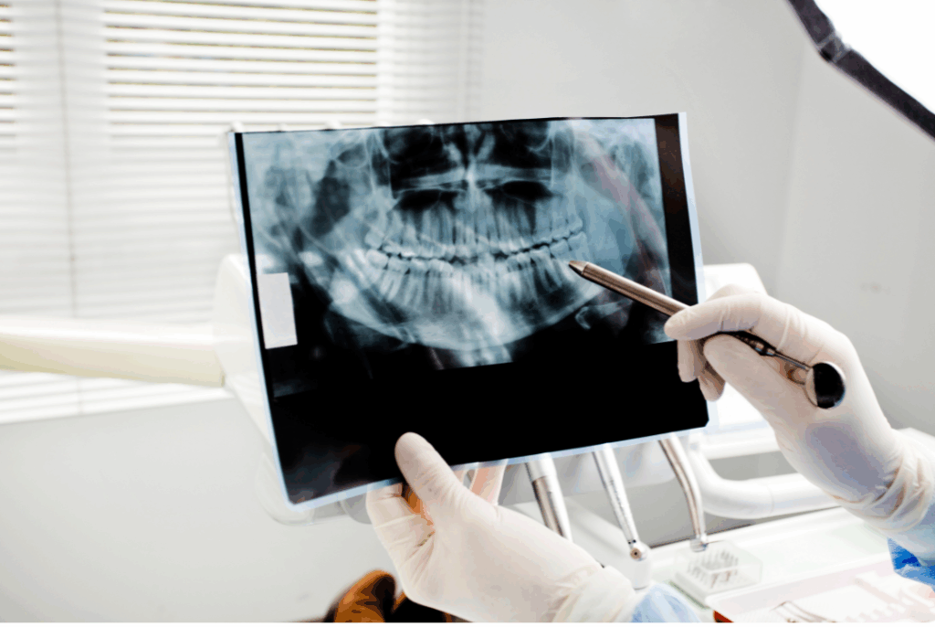 San Jose dentist reviewing panoramic dental X-ray with a patient to discuss oral surgery and wisdom teeth removal at Manassra Dental.