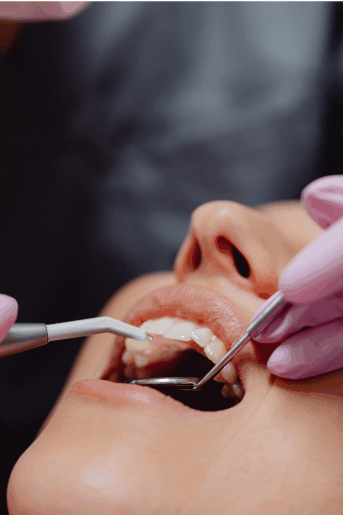 Close-up of a dentist performing precise dental work on a patient, representing the placement of a **temporary dental restoration** at Manassra Dental in San Jose.