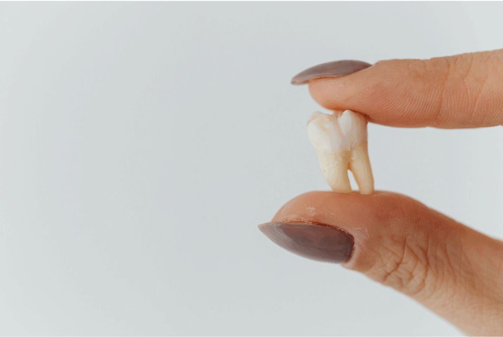 Single extracted tooth held by a hand, representing a quick and comfortable **simple tooth extraction** procedure at Manassra Dental in San Jose.