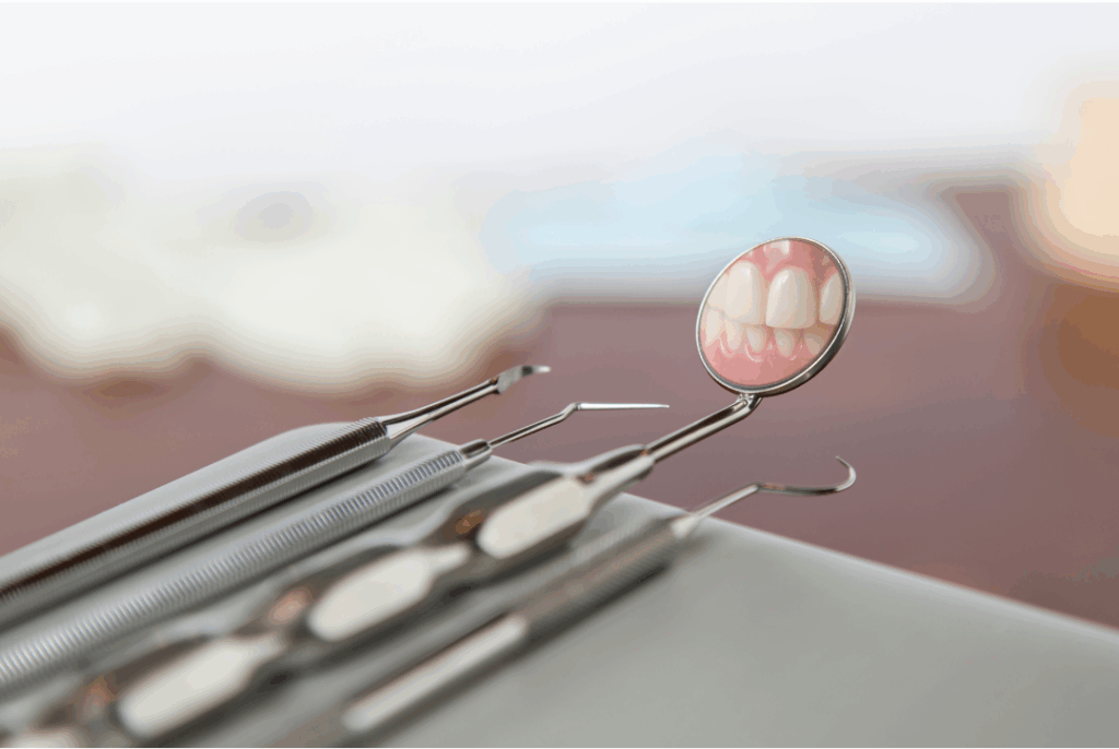 Dental professional holding a plaster cast model of a patient's teeth and bite, used for analysis during a **periodic oral exam** at Manassra Dental in San Jose.