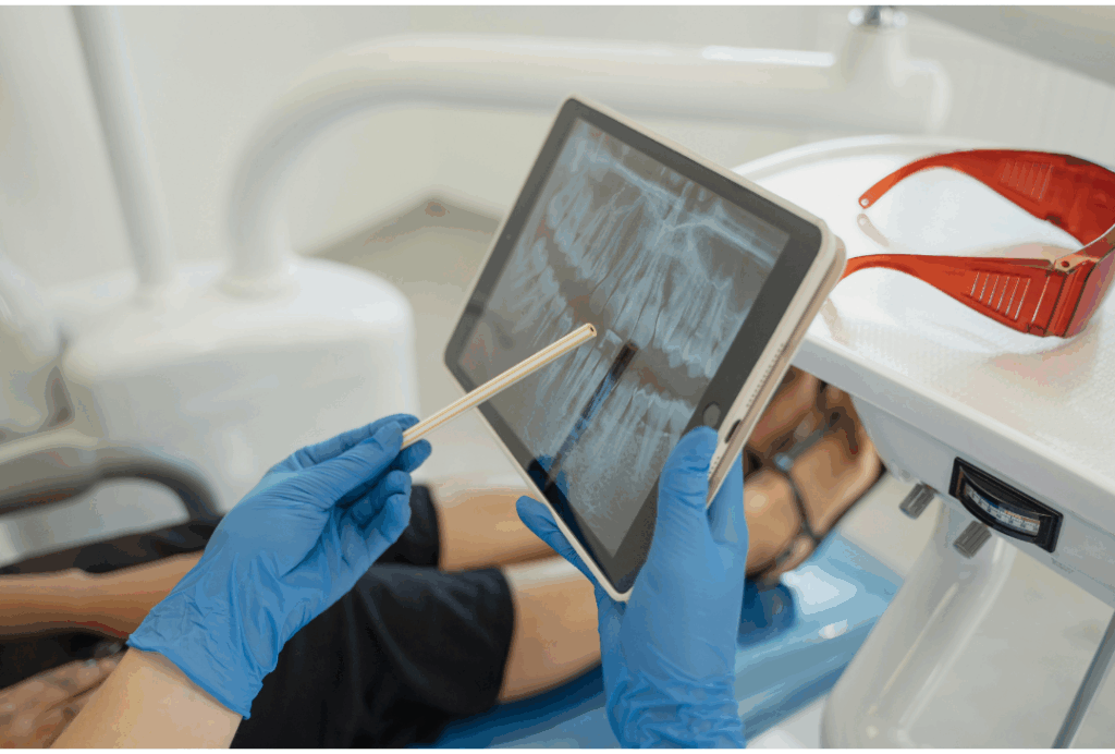 Dentist showing a patient's panoramic X-ray on a digital tablet, pointing out areas requiring treatment, illustrating the precise diagnostics for **Expert Periodontal Care** at Manassra Dental in San Jose.