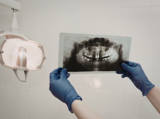 A dental professional at Manassra Dental holding a panoramic X-ray film up to a dental light for precise diagnostic review.