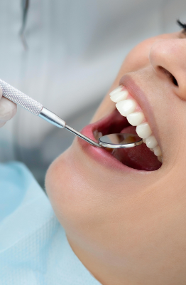 Close-up of a dentist at Manassra Dental performing a professional cleaning (prophylaxis) using a dental mirror and probe.
