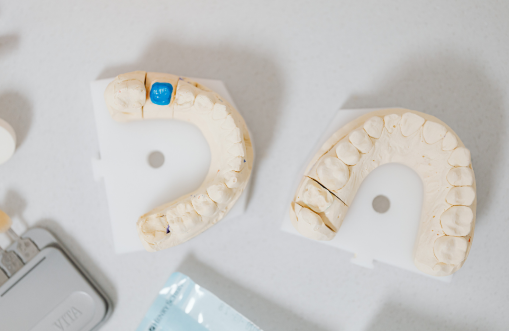 Top-down view of dental arch models showing a blue marked tooth for a custom crown.