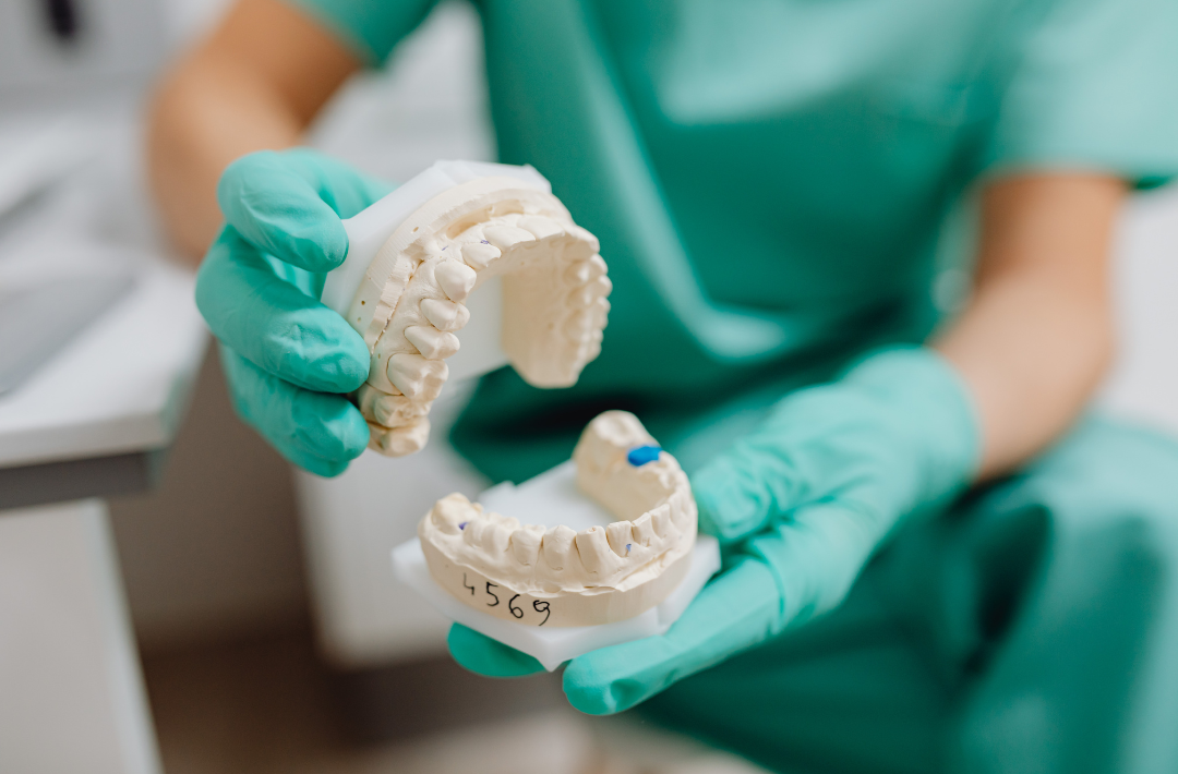 A dental professional wearing green gloves holding plaster dental study models.