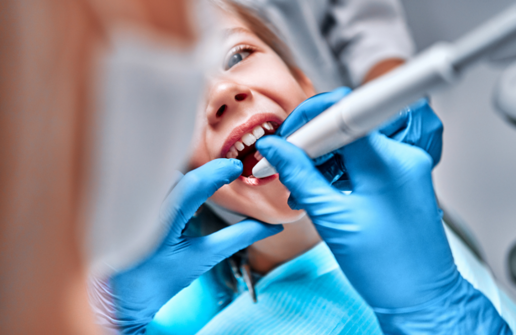 A close-up of a young child receiving a dental filling at Manassra Dental, with a clinician using a precision handpiece.