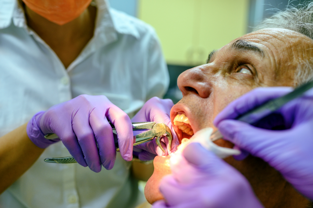 A dentist at Manassra Dental performing a gentle tooth extraction using specialized forceps on a patient.