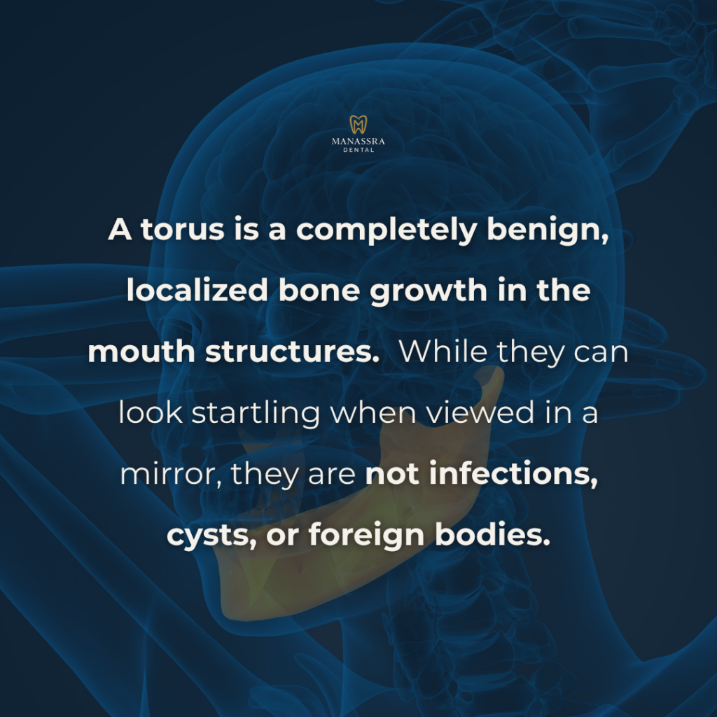 torus mandibularis